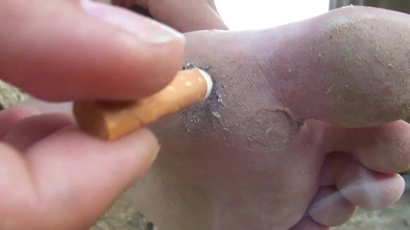 Cover 2 Clip 946 - HD/MP4