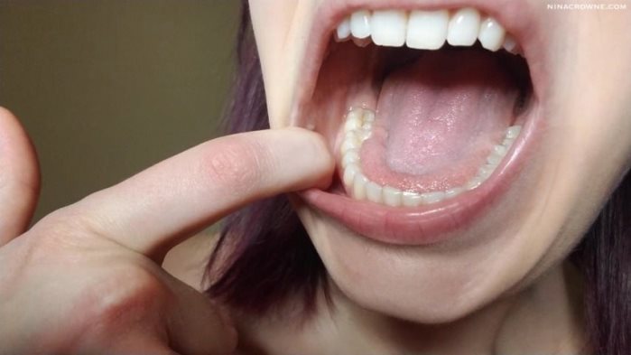 Cover 2 Nina Crowne - Dental Mouth Exploration - HD/MP4
