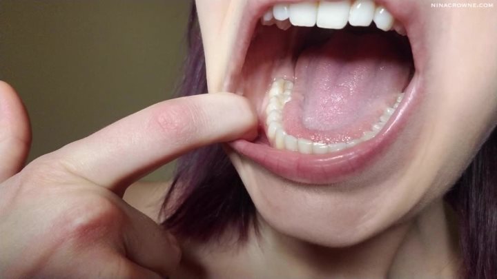 Cover 3 Nina Crowne - Dental Mouth Exploration - HD/MP4